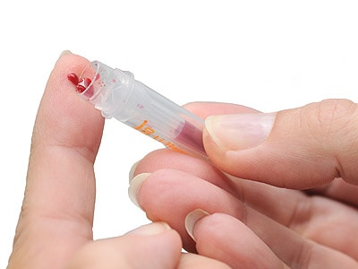 FOODTEST - gyűjtse a kicsepegő vért a csőbe